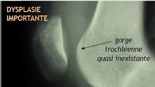 illus_rotule_3