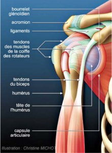 rupturecoiffe-1