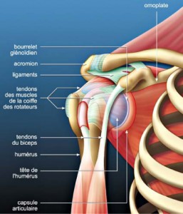 tendinopathie-1